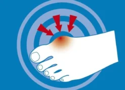 epitact Epithelium 26® Hallux valgus-Schutz