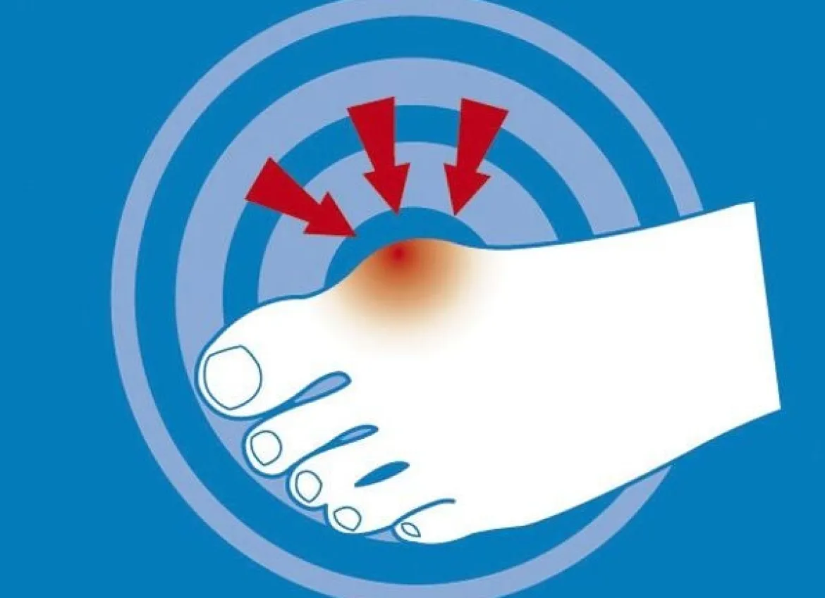 epitact Epithelium 26® Hallux valgus-Schutz
